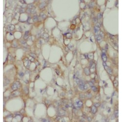 Chondroitin Polymerizing Factor (CHPF) Antibody