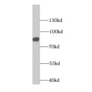 WB analysis of COLO 320 cells, using CHPF antibody (1/1000 dilution).