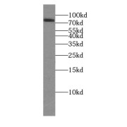 WB analysis of human placenta tissue, using CHPF antibody (1/1000 dilution).