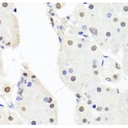 Chromatin Accessibility Complex 1 (CHRAC1) Antibody