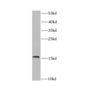 WB analysis of K-562 cells, using CHRAC1 antibody (1/1000 dilution).