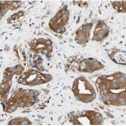 Cholinergic Receptor, Nicotinic Alpha 3 (CHRNA3) Antibody