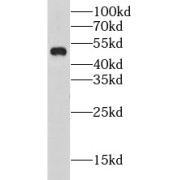 WB analysis of Jurkat cells, using CHRNA5 antibody (1/500 dilution).