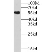 WB analysis of SH-SY5Y cells, using CHRNB4 antibody (1/500 dilution).