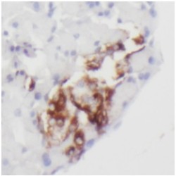 Chromogranin A (CHGA) Antibody