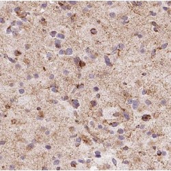Carbohydrate Sulfotransferase 10 (CHST10) Antibody
