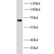 WB analysis of mouse heart tissue, using CHST3 antibody (1/800 dilution).