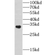 WB analysis of mouse heart tissue, using CHST8 antibody (1/1000 dilution).