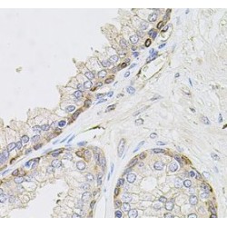 Calcium And Integrin-Binding Protein 1 (CIB1) Antibody