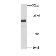 WB analysis of human liver tissue, using CIB1 antibody (1/1000 dilution).