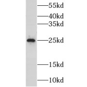 WB analysis of mouse heart tissue, using CIDEA antibody (1/1000 dilution).