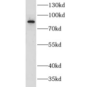 WB analysis of K-562 cells, using CILP2 antibody (1/500 dilution).