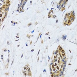 Cold-Inducible RNA-Binding Protein (CIRBP) Antibody