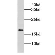 WB analysis of mouse skeletal muscle tissue, using mitoNEET, CISD1 antibody (1/4000 dilution).