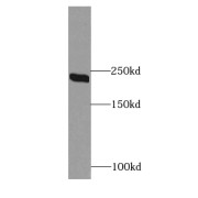 WB analysis of A431 cells, using CIT antibody (1/600 dilution).