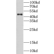 WB analysis of HEK-293 cells, using CS antibody (1/2000 dilution).