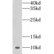 WB analysis of Rat live tissue, using CKS2 antibody (1/1000 dilution).