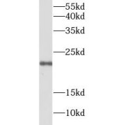 WB analysis of SW620 cells, using Claudin 1 antibody (1/1000 dilution).