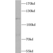 WB analysis of 293T cells, using CLCN1 antibody (1/1000 dilution).