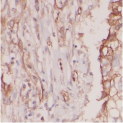 C-Type Lectin Domain Family 1 Member A (CLEC1A) Antibody