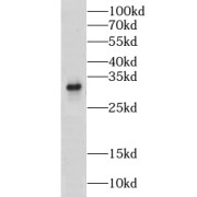 WB analysis of mouse lung tissue, using CLEC1A antibody (1/300 dilution).