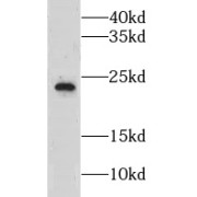 WB analysis of Human plasma tissue, using CLEC3B antibody (1/1000 dilution).