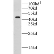 WB analysis of Transfected HEK-293 cells, using CLEC4M antibody (1/3000 dilution).