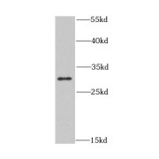 WB analysis of HL-60 cells, using CLIC1 antibody (1/1000 dilution).