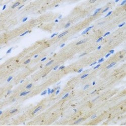 CAP-Gly Domain Containing Linker Protein 1 (CLIP1) Antibody