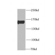 WB analysis of mouse brain tissue, using CLIP1 antibody (1/1000 dilution).