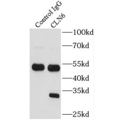 Ceroid-Lipofuscinosis Neuronal Protein 6 (CLN6) Antibody