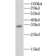 WB analysis of SH-SY5Y cells, using CLN6 antibody (1/1000 dilution).