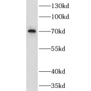 WB analysis of MCF-7 cells, using CLPB antibody (1/300 dilution).