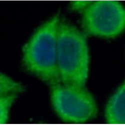 Putative ATP-Dependent Clp Protease Proteolytic Subunit, Mitochondrial (CLPP) Antibody