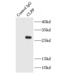 Putative ATP-Dependent Clp Protease Proteolytic Subunit, Mitochondrial (CLPP) Antibody