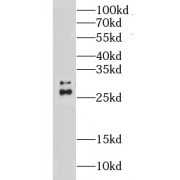 WB analysis of K-562 cells, using CLPP antibody (1/500 dilution).