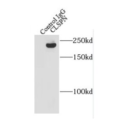 Claspin (CLSPN) Antibody