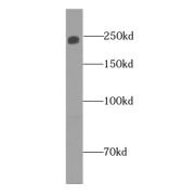 WB analysis of HEK-293 cells, using Claspin antibody (1/300 dilution).