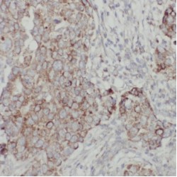 Clathrin Light Chain A (CLTA) Antibody