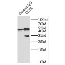 Clathrin Light Chain A (CLTA) Antibody