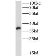 WB analysis of mouse brain tissue, using CLTA antibody (1/800 dilution).