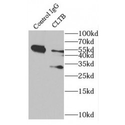 Clathrin Light Chain B (CLTB) Antibody