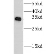 WB analysis of mouse thymus tissue, using CLTB antibody (1/600 dilution).