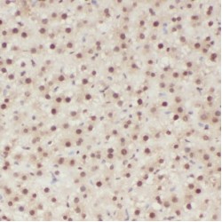 Citrate Lyase Beta Like (CLYBL) Antibody