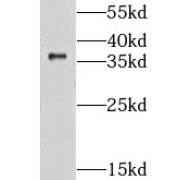 WB analysis of HeLa cells, using CLYBL antibody (1/600 dilution).