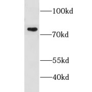 WB analysis of Raji cells, using CMIP antibody (1/400 dilution).