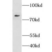 WB analysis of HL-60 cells, using c-Myb antibody (1/500 dilution).