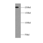 WB analysis of HeLa cells, using CEP250/CNAP1 antibody (1/500 dilution).