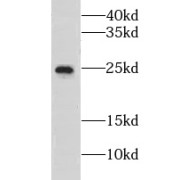 WB analysis of mouse testis tissue, using CNBP antibody (1/300 dilution).