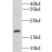 WB analysis of SK-BR-3 cells, using CNIH3 antibody (1/500 dilution).